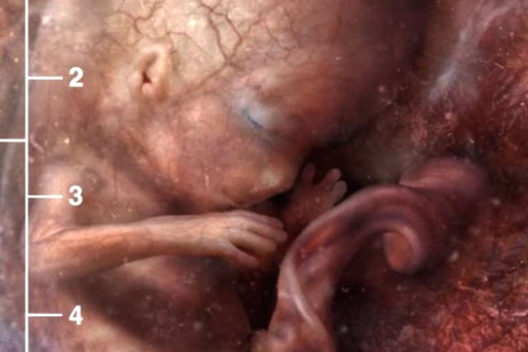 10 weeks fertilization (12 weeks gestation)
