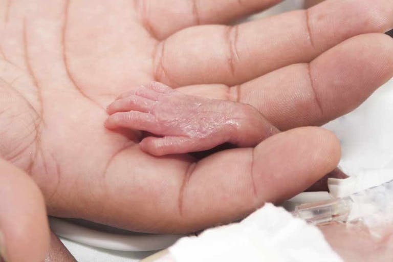 premature, born alive, Rhode Island, abortion