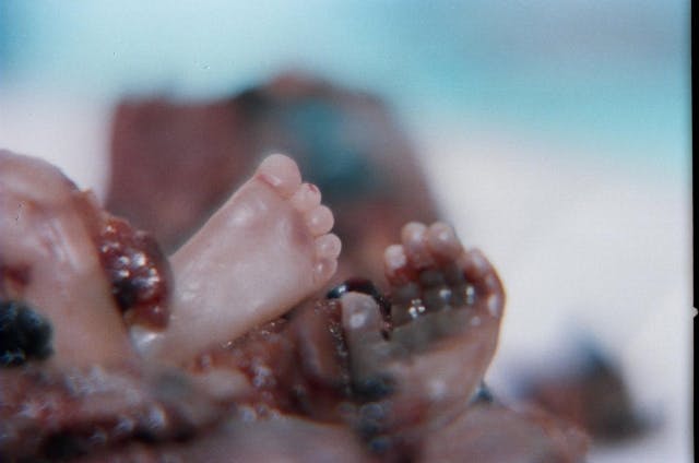 Hands and feet of 21-week-old aborted baby. FBI, aborted