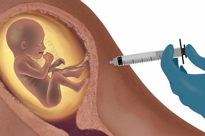 abortion, Kaiser Permanente