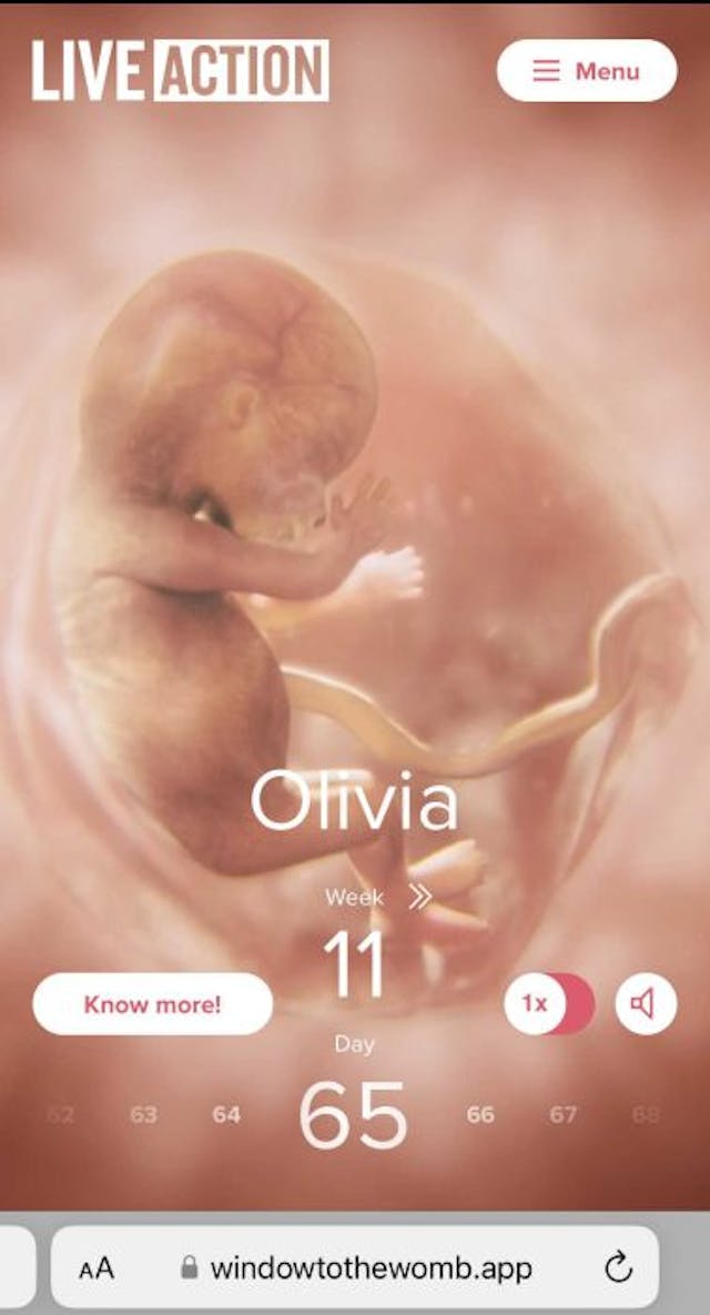 Window to the Womb, 11 weeks Arizona judge strikes ‘unborn human being’ from abortion ballot pamphlet image