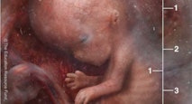 preborn fetus 9 weeks post-fertilization