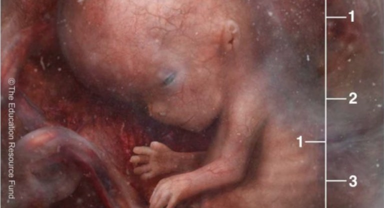 preborn fetus 9 weeks post-fertilization