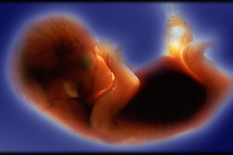 scientific american, roe v. wade, preborn baby, fetus, biology