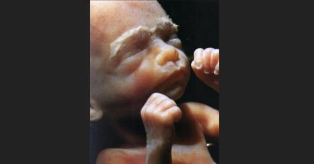 Preborn child 24 weeks gestation