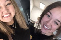 melanie vazquez – during and after prednisone