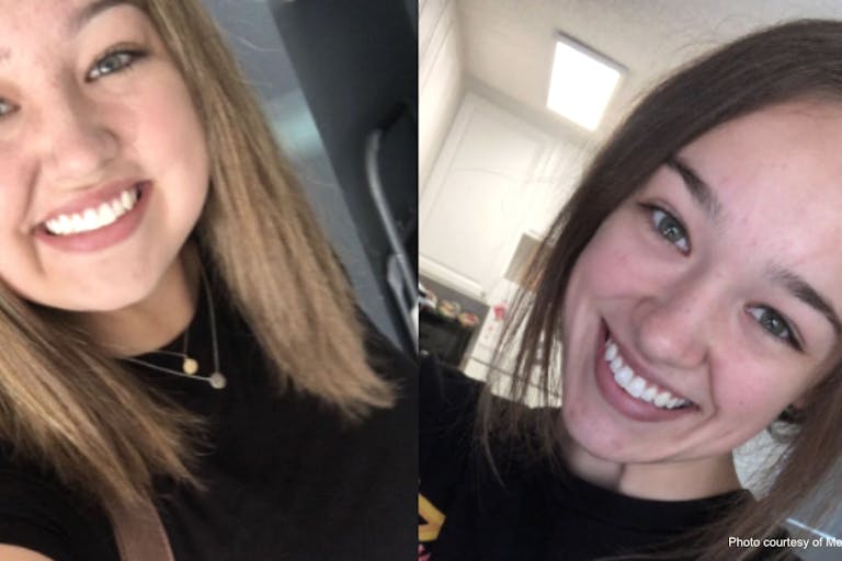 melanie vazquez – during and after prednisone