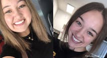 melanie vazquez – during and after prednisone