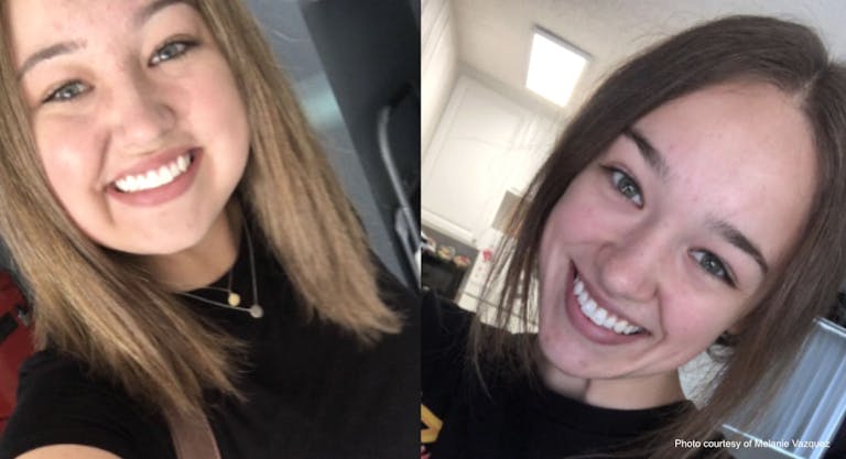 melanie vazquez – during and after prednisone