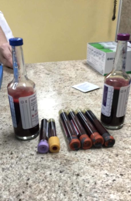 One of Melanie’s many blood draws (photo courtesy of author – do not reprint)