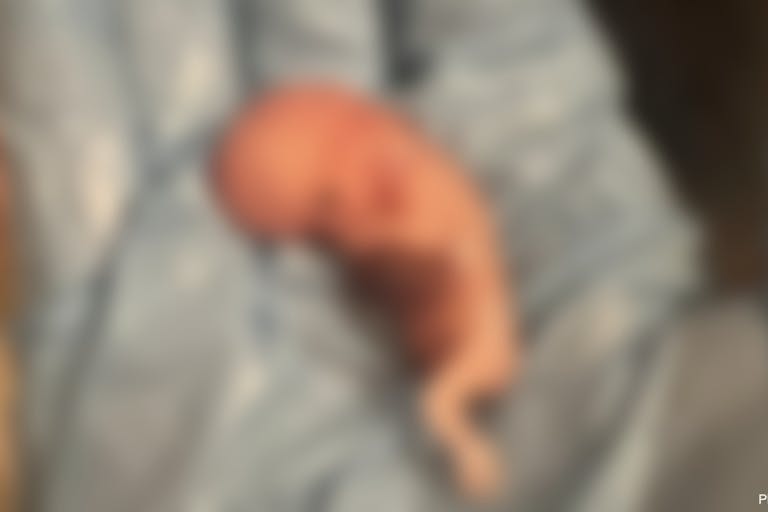 abortion, abortion pill