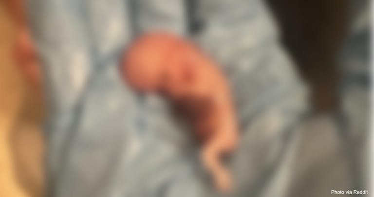 abortion, abortion pill