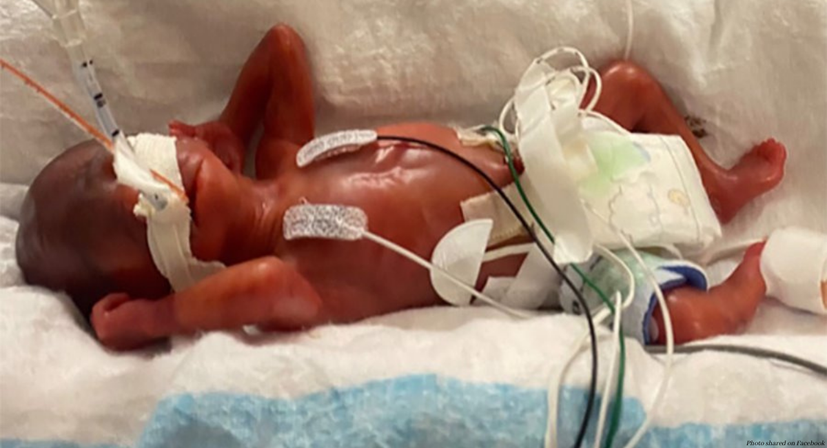 World’s youngest preemie, born just over 21 weeks, celebrates his fourth birthday featured image