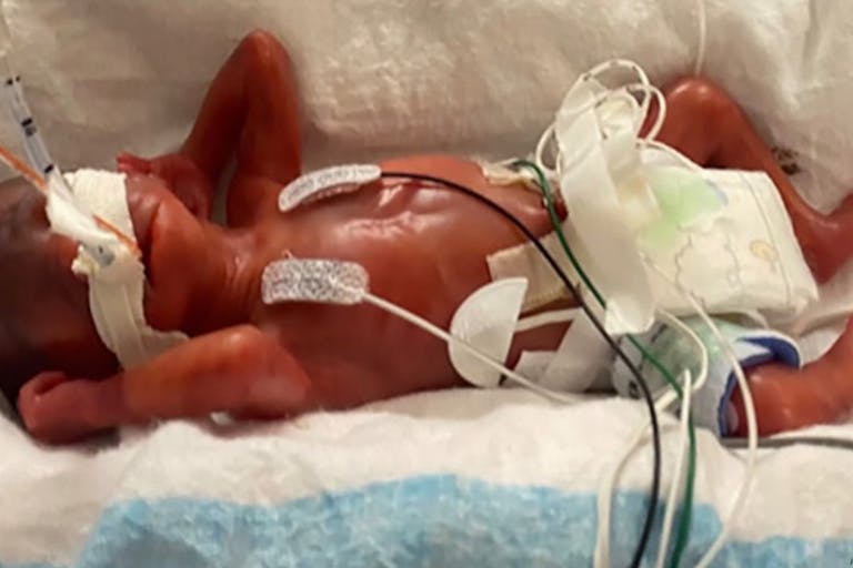 Curtis Means 2 World’s youngest preemie, born just over 21 weeks, celebrates his fourth birthday featured image