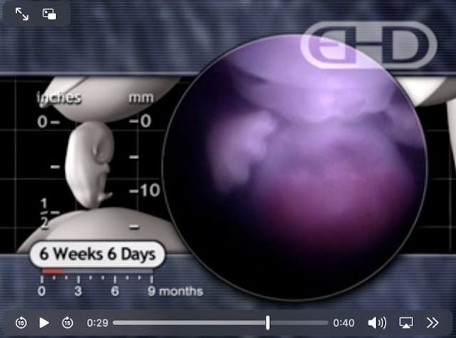 Arkansas House passes prenatal education bill, which now advances to Senate image