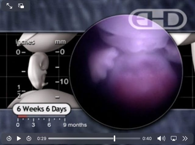 EHD screenshot, 6 weeks and 6 days after fertilization Arkansas House passes prenatal education bill, which now advances to Senate image