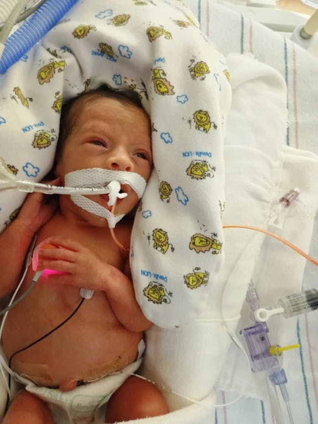 Courtesy Banner-University Medical Center One in 40 million odds: Couple welcomes identical quadruplets image