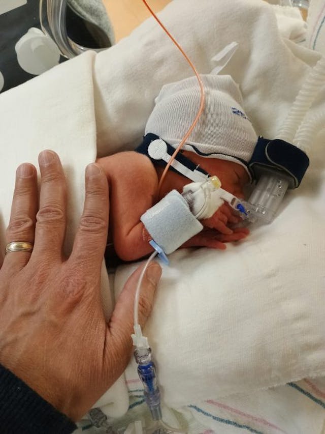 Courtesy Banner-University Medical Center quadruplets