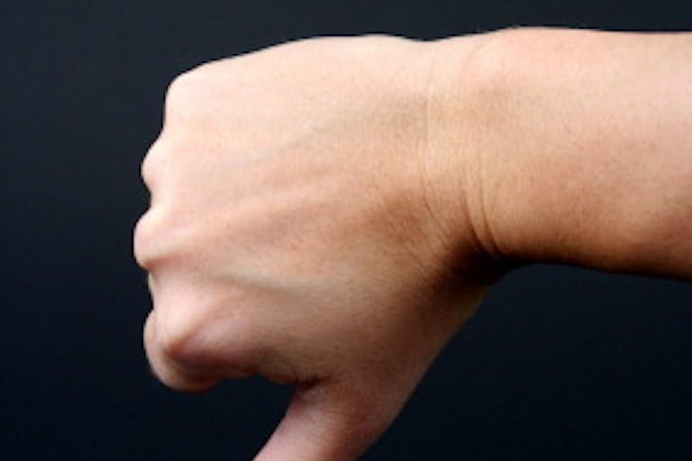 Hand Down