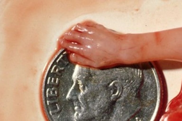 A baby’s hand at only 10 weeks. Abortion industry hopes to destigmatize abortion by offering women option of seeing remains image