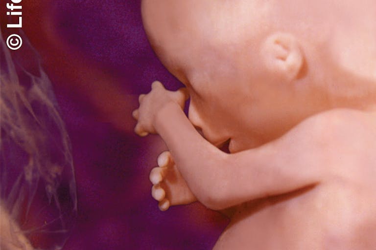 16-weeks-human-fetus2