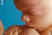 20-weeks-human-fetus