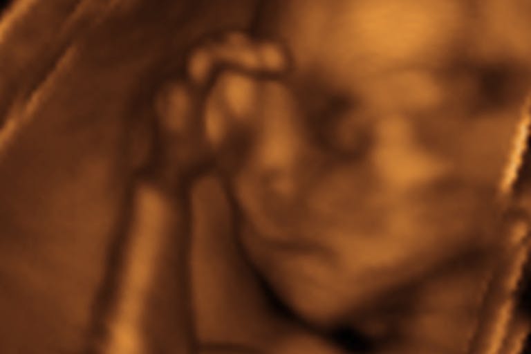 3d-ultrasound-fetus-baby3