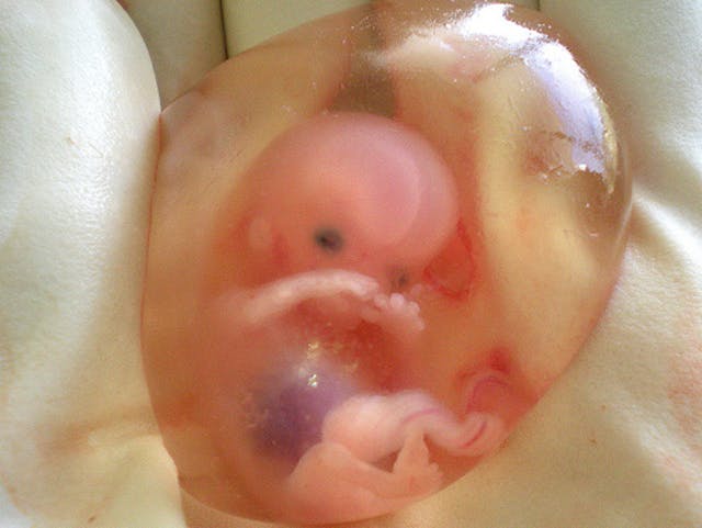 A baby in her first trimester preborn, first trimester