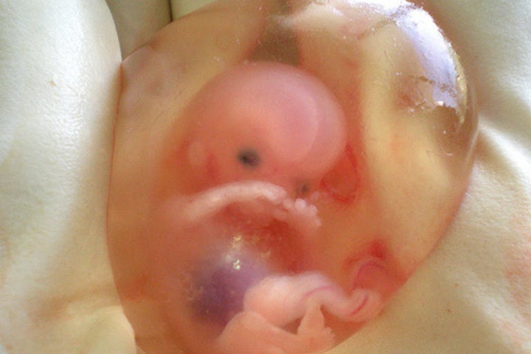 A baby in her first trimester preborn, first trimester