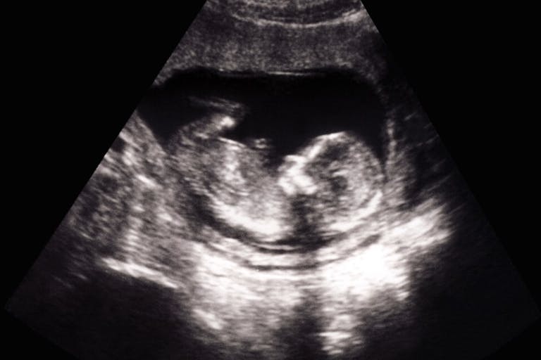 pro-life, Georgia heartbeat, abortion restrictions