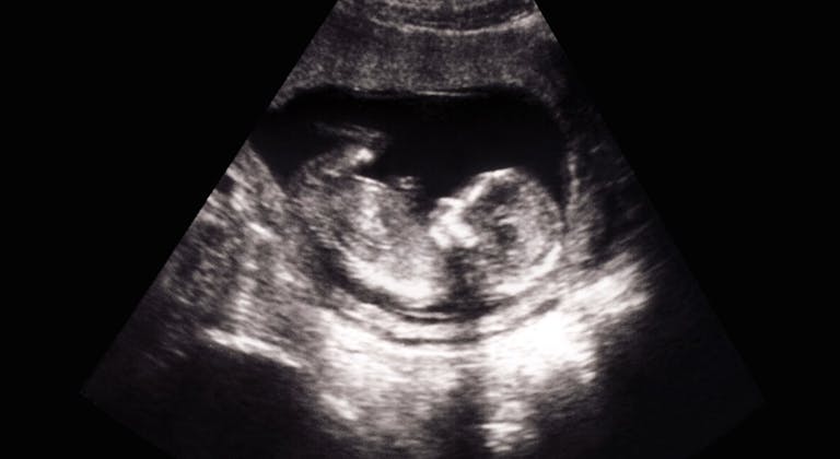 pro-life, Georgia heartbeat, abortion restrictions