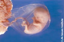 8-week-old preborn child Mexican Supreme Court case could open door to legalized abortion throughout Mexico image