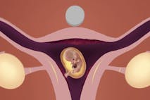 abortions, abortion pill reversal