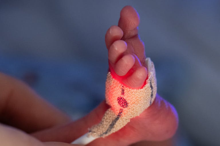 Premature babies are accompanied into life