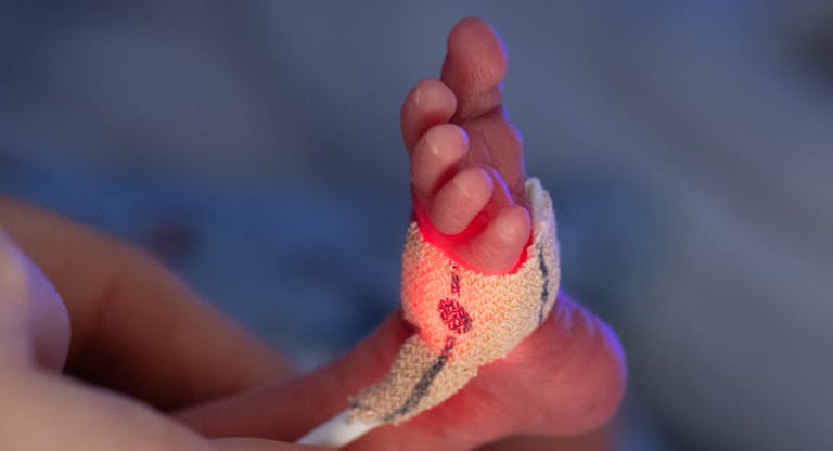 Premature babies are accompanied into life