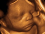 ultrasound, Vermont