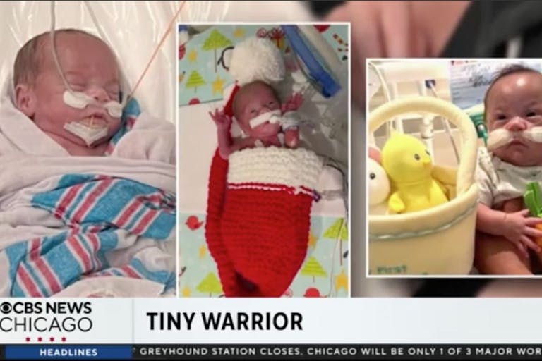 NICU, premature, newborn