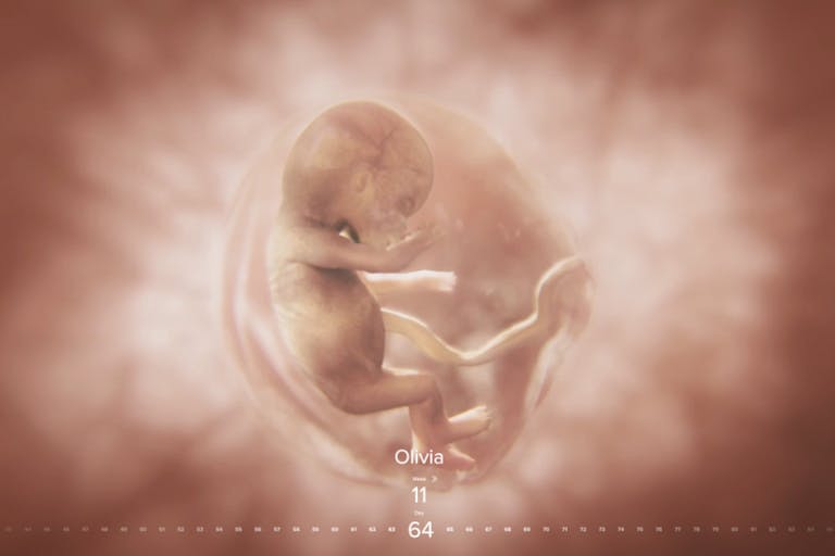 Iowa, Baby Olivia, prenatal development