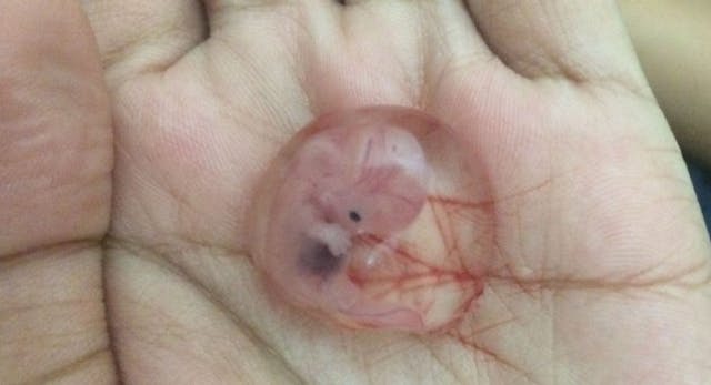 Top Myths DEBUNKED: Human prenatal development image