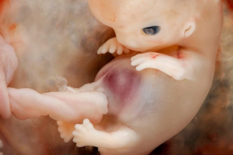 first trimester, polish bishops, abortion pill, 8 weeks, abortion procedures videos, heartbeat, fetus, embryo, south carolina, poland