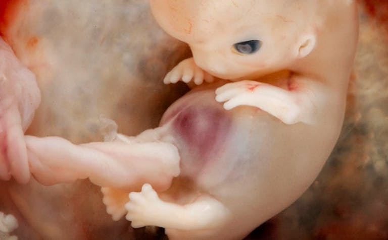 first trimester, polish bishops, abortion pill, 8 weeks, abortion procedures videos, heartbeat, fetus, embryo, south carolina, poland