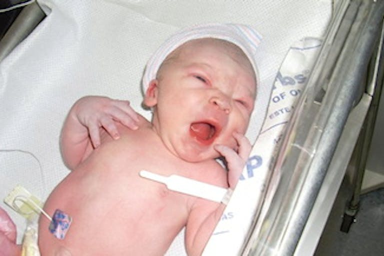baby abortion