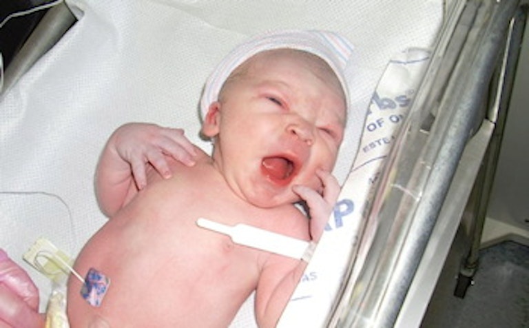baby abortion