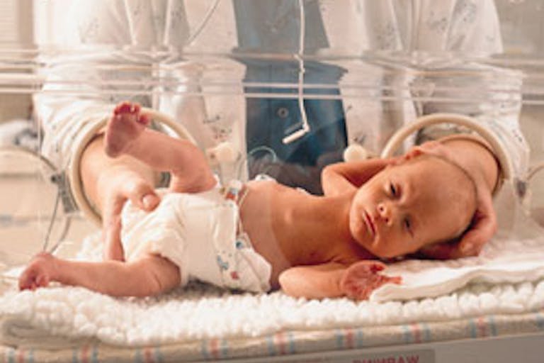 premature baby