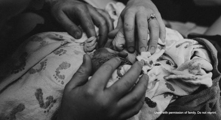 baby emanuelle trisomy 18