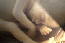 human-fetus-lights