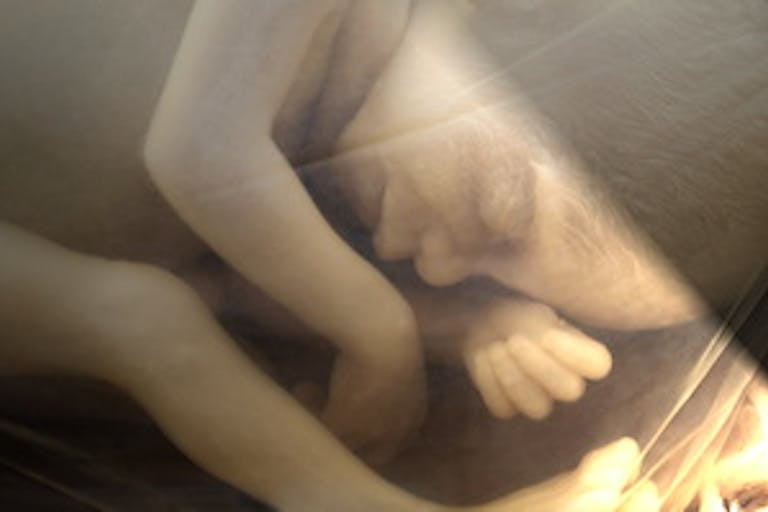 human-fetus-lights