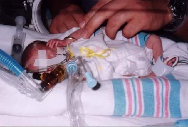 Hayley Good in the NICU unit at Nationwide Children’s Hospital in Columbus, Ohio