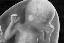 pregnancy, abortion, Facebook