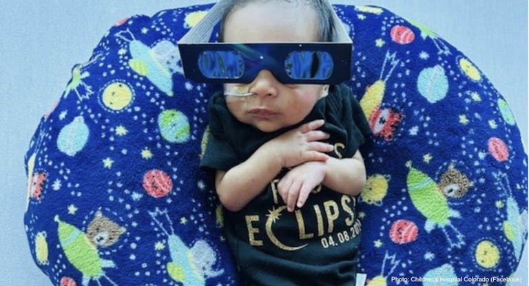 childrens hospital colorado eclipse baby